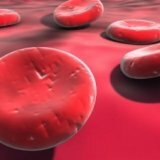 Какие показатели крови указывают на лейкемию