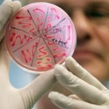 Иммуноферментный анализ и исследование болезней