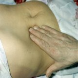 Заболевания печени признаки и симптомы