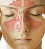Гайморит является опасным заболеванием