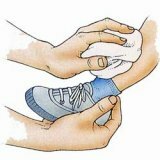 Домашние средства против ушибов и синяков