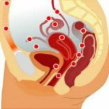 Предраковые заболевания женских половых органов