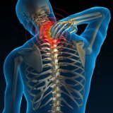 Виды и проявления остеохондроза у человека