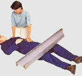 Синдром длительного сдавления при травме