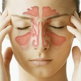 Внутричерепные осложнения риногенной инфекции