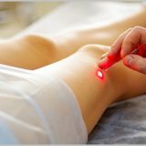 Как убрать сосудистые звездочки на ногах